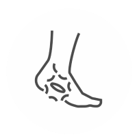Simple line drawing of an ankle with a highlighted area.